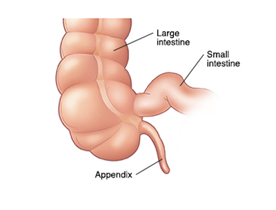 Appendix