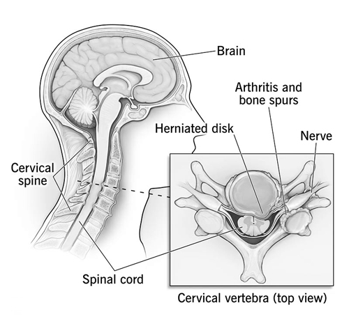 Cervical Spine