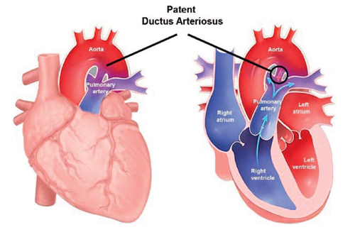 Ductus