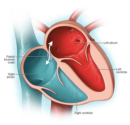 Fossa Ovale