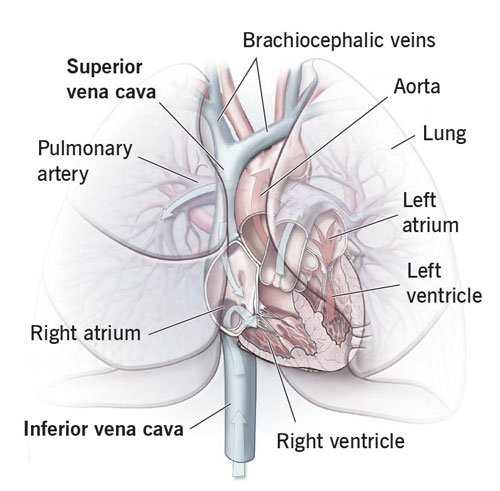 Inferior Vena Cava