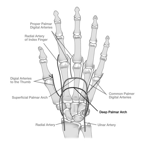 Palmar Arch