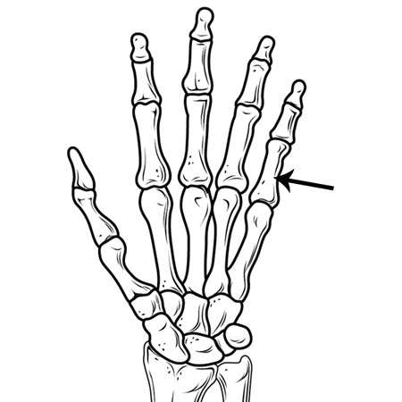 Phalanges