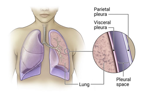 Pleura