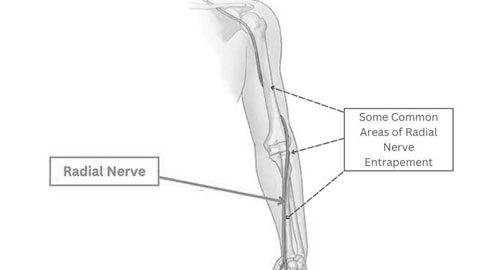 Radial Nerve