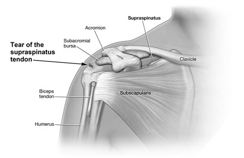 Rotator Cuff