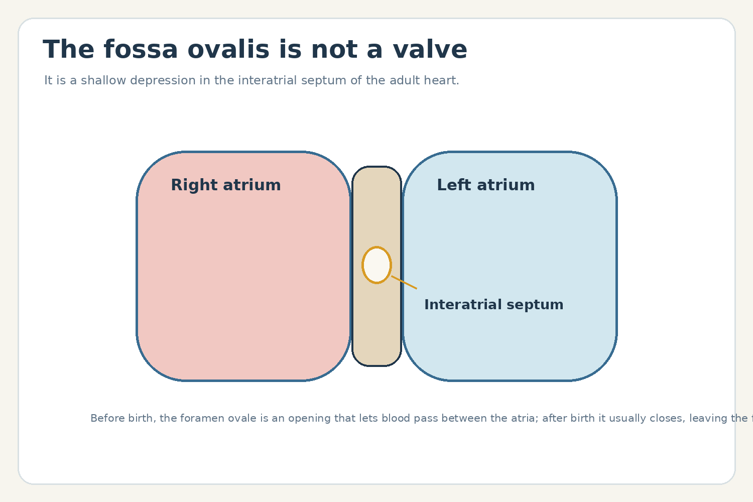 Simplified heart diagram marking the fossa ovalis in the interatrial septum.